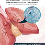 Buku Tuberkulosis