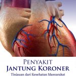Buku Penyakit Jantung Koroner: Tinjauan Dari Kesehatan Masyarakat