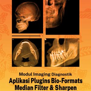 Buku Modul Imaging Diagnostik Aplikasi Plugins Bio-Formats Median Filter & Sharpen Pada Citra Endodontik Cone Beam Computed Tomography