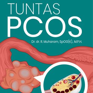Buku Kupas Tuntas PCOS