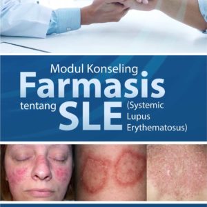 Modul Konseling Farmasis Tentang SLE (Systemic Lupus Erythematosus)