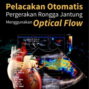 Buku Pelacakan Otomatis Pergerakan Rongga Jantung Menggunakan Optical Flow