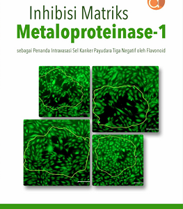 Buku Inhibisi Matriks Metaloproteinase-1 Sebagai Penanda Intravasasi Sel Kanker Payudara Tiga Negatif oleh Flavonoid