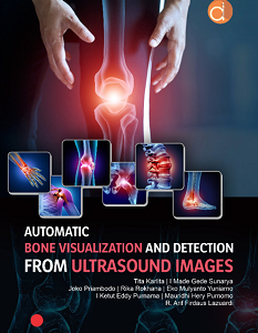 Buku Automatic Bone Visualization And Detection From Ultrasound Images