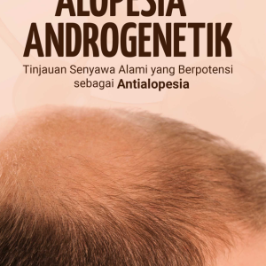 Buku Alopesia Androgenetik Tinjauan Senyawa Alami yang Berpotensi sebagai Antialopesia