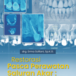 Buku Restorasi Pasca Perawatan Saluran Akar : Sebuah Tinjauan Klinis dan Radiografis