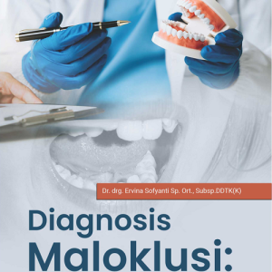 Buku Diagnosis Maloklusi: Tantangan di Masa Tumbuh-Kembang