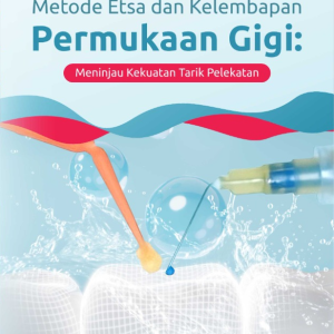 Buku Metode Etsa dan Kelembapan Permukaan Gigi: Meninjau Kekuatan Tarik Pelekatan