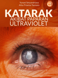 Buku Katarak Akibat Paparan Ultraviolet