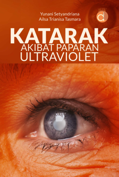 Buku Katarak Akibat Paparan Ultraviolet
