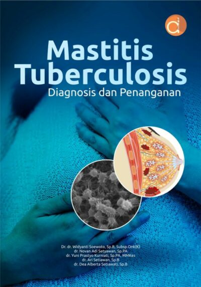 Buku Mastitis Tuberculosis Diagnosis dan Penanganan