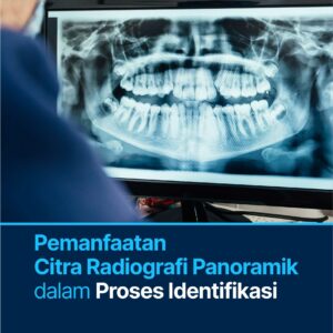 Buku Pemanfaatan Citra Radiografi Panoramik dalam Proses Identifikasi
