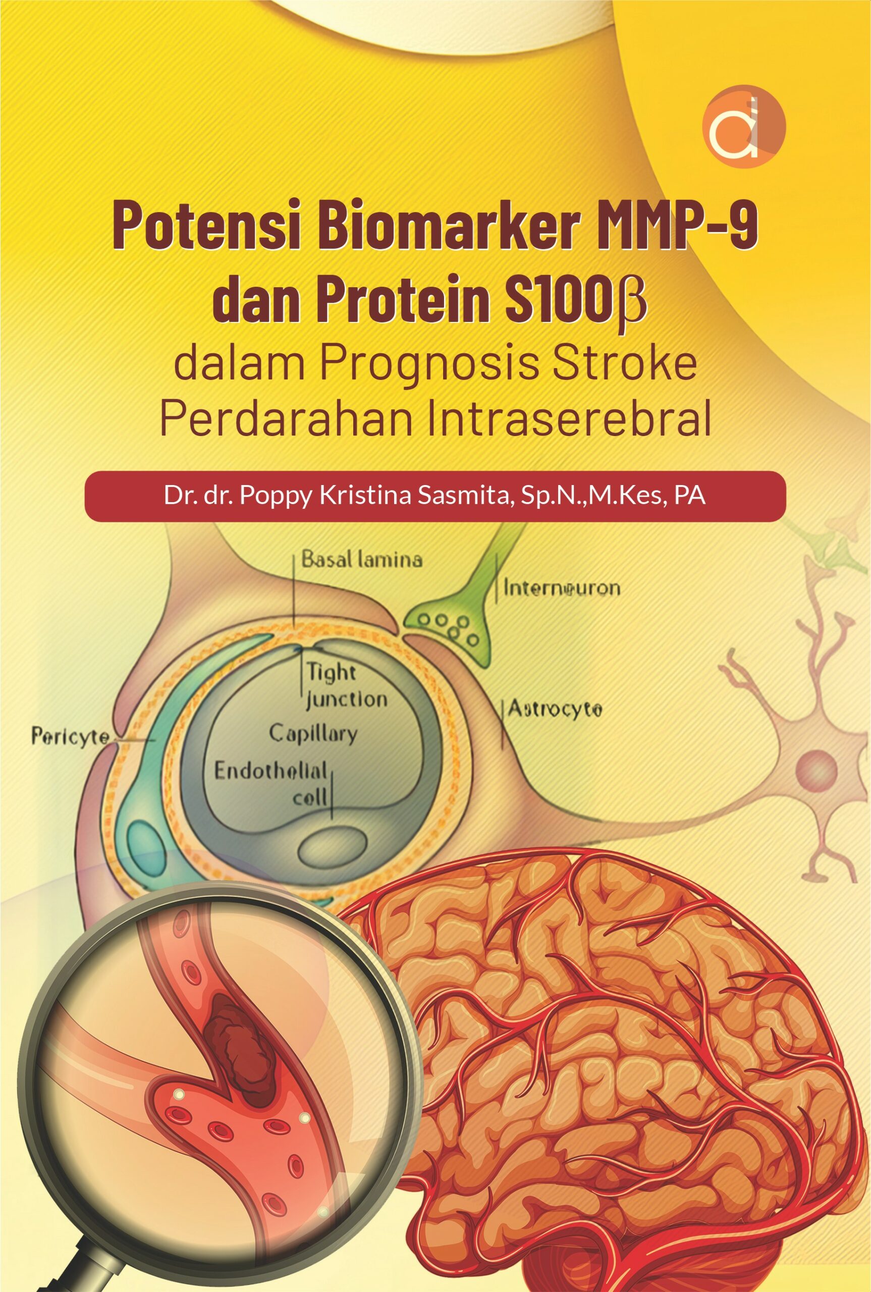 Buku Potensi Biomarker MMP-9 dan Protein S100b dalam Prognosis Stroke Perdarahan Intraserebral