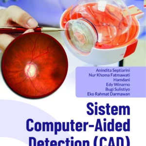 Buku Sistem Computer-Aided Detection (CAD) untuk Penyakit Glaukoma