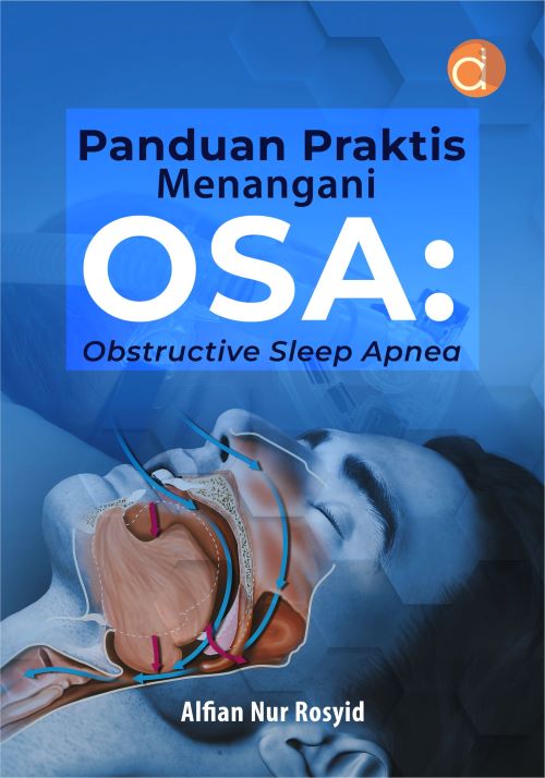 Buku Panduan Praktis Menangani Osa: Obstructive Sleep Apnea
