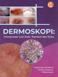 Buku Dermoskopi: Interpretasi Lesi Kulit, Rambut Dan Kuku